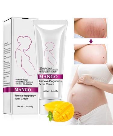 Fengyang stretch strips cream scar removal removal cream stretch strip repair cream pregnancy scars cream stretch marks cream 40g - Buy Online on GoSupps.com