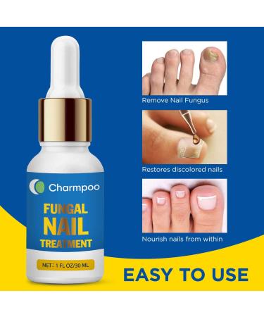 Antifungal Nail Treatment - Potent Toe Nail Fungal Treatment for Men and Women - 1Fl Oz/30ml - Buy Online on GoSupps.com