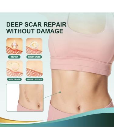 Medical Grade Silicone Scar Sheets - Professional Scar Removal Tape (1 x 120 Pack of 2) for Keloid C-Section Surgery & Burns - Reusable & Effective Treatment - Buy Online on GoSupps.com