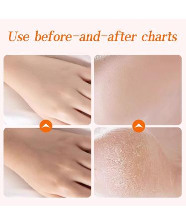 Gold Honey Hand Mask Wax | Hydrating & Nourishing Peel Off Handmask for Soft Skin - Buy Online on GoSupps.com