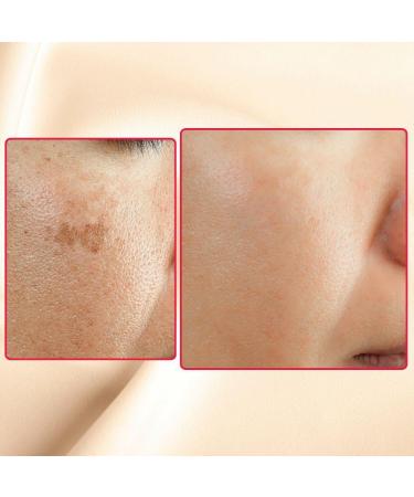 Shop Gymsegb Eraser Cream - 1 oz for Flawless Skin | International Shipping Available - Buy Online on GoSupps.com