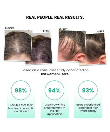 Thrive.Co Rosemary Water Hair Spray | With 100% Natural Rosemary Extract Rice Water & Hyaluronic Acid | For Hair Growth Hair Fall Control Hair Conditioning & Hair Shine | Men & Women 100ml - Buy Online on GoSupps.com