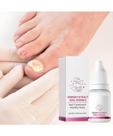  G n rique Nail Hardener Nails Nutrient Oil 10ml Natural Cuticle Oils Repair Softener Optimal Nail Revitalization for Foot Care Fingernails Yellow Toenail Ingrown Women and Men - Buy Online on GoSupps.com