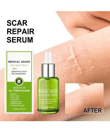 lmoikesz Leg Hip Chest Stretch Marks Serum Body Burns Scars Removal Serum Girls Skin Care Repair Essence 30ml - Buy Online on GoSupps.com