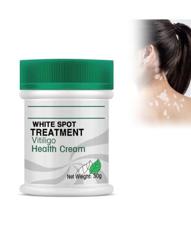 Utapossin Anti-blemish cream delicate herbal extract removes dark spots anti-melanin whitens easy to apply improves skin pigmentation