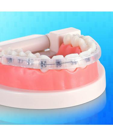 Obrush Clip-on Comfort Covers for Braces - Orthodontic Lip Protector & Wax Cover | Braces Accessories - Buy Online on GoSupps.com