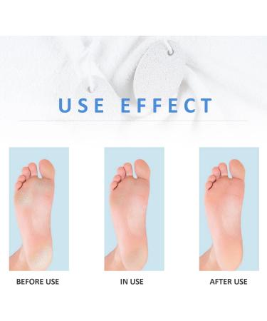 4Pcs Pumice Stone for Feet Includes 2Pcs Natural Pumice Stone 2Pcs Double Sided Pedicure Glass Stone for Feet and Hands Exfoliation to Remove Dead Skin - Buy Online on GoSupps.com