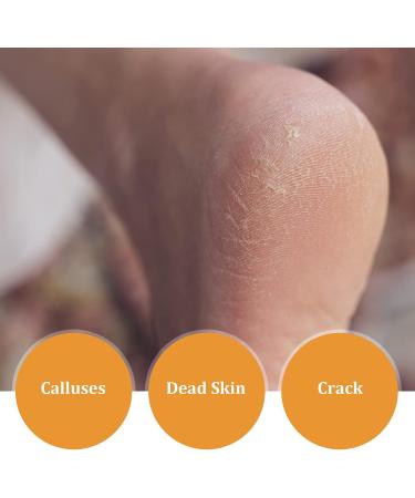 Nano Foot Scrubber Professional Foot File Double Sided Glass with Nano-Level Grinding Points for Cracked Dry Skin for Dead Skin Removal for Wet and Dry Feet - Buy Online on GoSupps.com