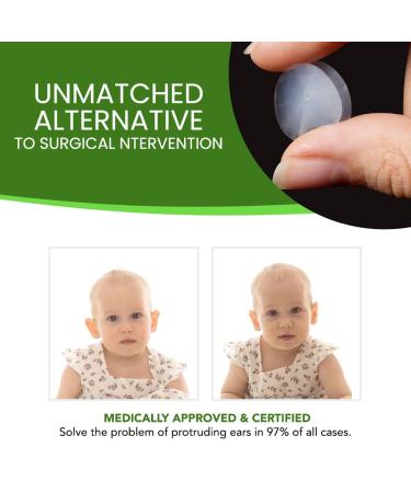 PrettyEars Cosmetic Ear Correctors for Babies - 4 Pairs, Transparent Silicone Adhesive Tape for Prominent Protruding Ears - Buy Online on GoSupps.com