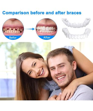 High-Quality Artificial Teeth & Dentures Set - Cosmetic Veneers Dental Prosthesis Lightening Kit + Case & Tweezers - International Shipping Available - Buy Online on GoSupps.com