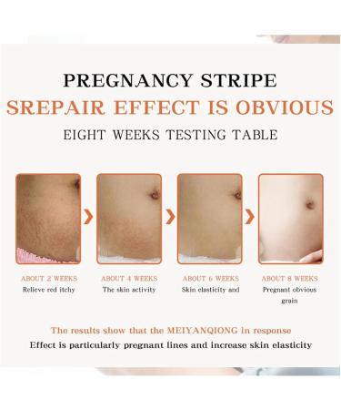 scar removal cream scar care cream scar treatment gel scar removal cream for surgical scars acne scars cesarean section - Buy Online on GoSupps.com