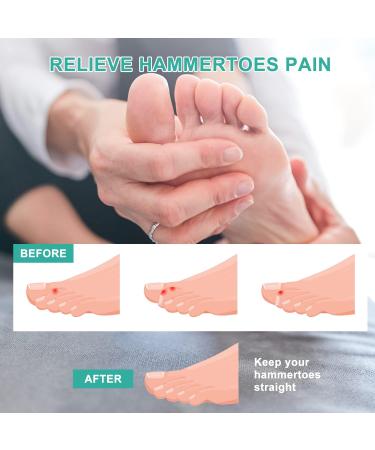 Toe Separator Hammer Toe Corrector for Women - Bunion Corrector for Crooked & Curled Toes | Protect Toes from Rubbing - 6 Pack - Buy Online on GoSupps.com