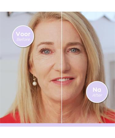 AGEFIT Anti-Aging Serum & Eye Cream Set - Reduce Wrinkles Firm Skin & Moisturize - 2x15ml - Unisex Facial Care - Buy Online on GoSupps.com