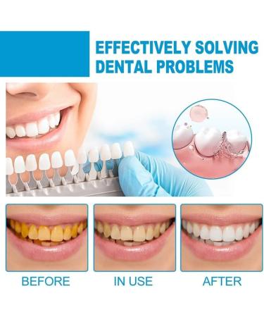 SP-4 Probiotic Rapid Whitening Toothpaste Fresh Breathe Whitening and Stain Removal Toothpaste Deep Cleaning Toothpaste Prevents Tartar - Buy Online on GoSupps.com