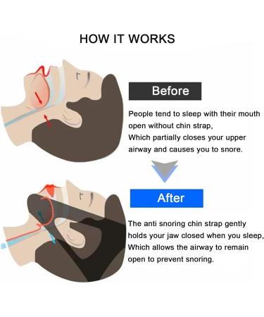 Anti Snoring Chin Strap - Adjustable Stop Snoring Solution for Men, Women, CPAP Users - Breathable Snore Stopper - Buy Online on GoSupps.com