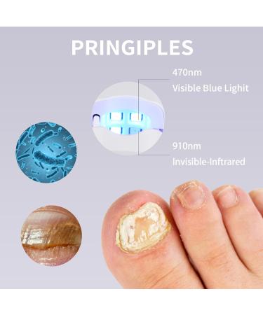 WEILASER Nail Fungus Cleaning Device Effective Home Solution for Discolored & Thick Toenails | 470nm Blue Light + 910nm Infrared Light - Buy Online on GoSupps.com