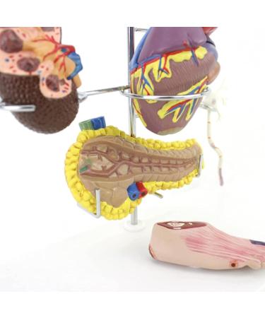 Diabetes Model Set Diabetes ICal Model Human Organ Coronary Artery Thrombosis Model Arteriosclerosis in Vitro - Buy Online on GoSupps.com