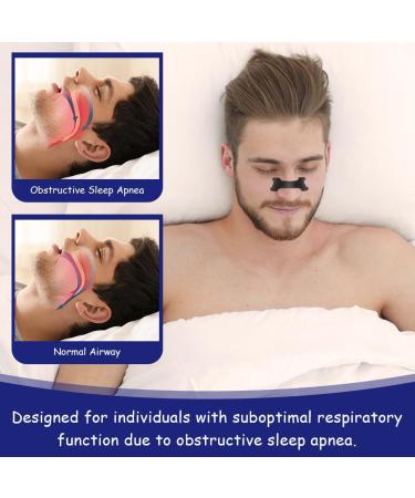 Acwoo Nose Paving Snoring Strips - 30 Anti-Snoring Nose Plasters for Better Sleep & Breathe | Stop Snoring Effectively - Buy Online on GoSupps.com