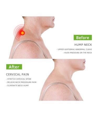 Posture Corrector for Costochondritis & Tietze Syndrome | Back Stretcher for Headache & Back Pain Relief - Green - Buy Online on GoSupps.com