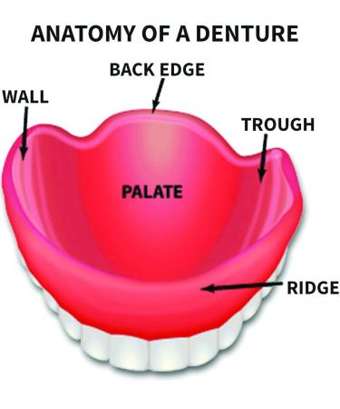 DenSureFit Lower Denture Reline Kit - Secure, Comfortable Fit | Easy DIY Solution - Buy Online on GoSupps.com