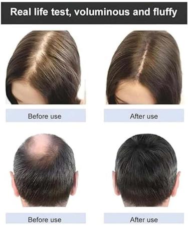 Ginger Plant Extract Anti-Hair Loss Hair Shampoo Plant Extract Ginger Shampoo for Hair Growth Ginger Anti Hair Loss Shampoo Oil Control Ginger Shampoo for Women & Men (1Box/200ML) - Buy Online on GoSupps.com