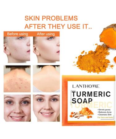 Buy Ginger Bar Soap & Turmeric Soap - Skin Cleansing Moisturizing Revitalizing | Eco-Friendly Soap Saver Bags Included | International Shipping - Buy Online on GoSupps.com