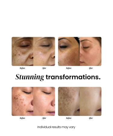 Elir Radiance & Renewal Serum with Hyaluronic Acid Vitamin C & Kojic Acid Hydrating Anti-Aging Formula for Smooth Even-Looking Skin Tone & Texture 30ml - Buy Online on GoSupps.com