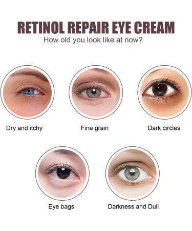 Eye Cream Anti Aging Retinol Eye Cream Eye Cream for Dark Circles and Puffy Eyes Firming Eye Cream Against Wrinkles with Retinol and Gentiana Extract Anti Wrinkle Eye Cream for All Skin Types - Buy Online on GoSupps.com
