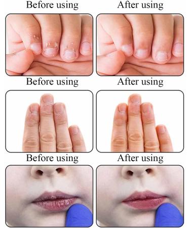 Anti Bite Nail Polish Nail Biting Treatment No Bite Thumb Sucking Stop for Children Kids - Buy Online on GoSupps.com