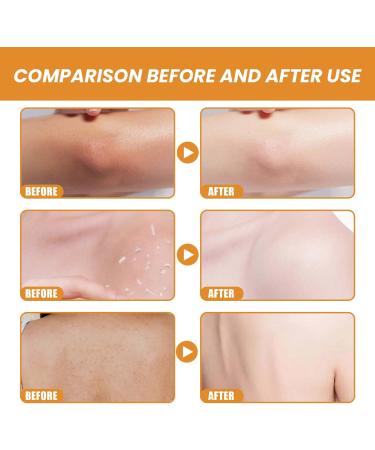 Gel exfoliant exfoliant pour le visage pour femme gel claircissant et claircissant gommage l'orange pour le visage des femmes r duit les taches de peau nettoyage en profondeur et lissage pour 3 pi ces. - Buy Online on GoSupps.com