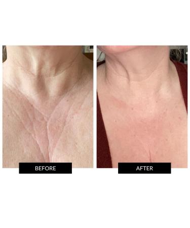 CurrentBody Skin Face Neck & D collet Set - Luxury Skincare Bundle for Radiant Skin | International Shipping Available - Buy Online on GoSupps.com