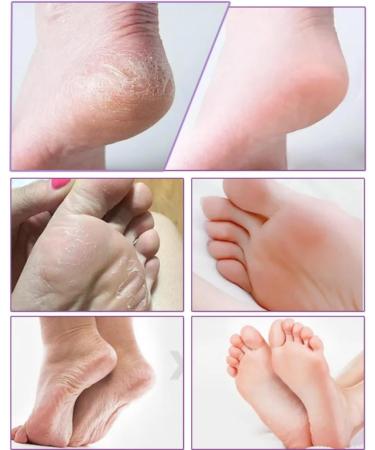 3Pairs Foot Peel Mask Foot Care Exfoliating Foot Peeling Mask for Dead Skin Exfoliating Socks Foot Mask Moisturizing Feet Peeling Mask for Dry Skin Skincare Socks for Women Foot Spa Peeling Foot Mask - Buy Online on GoSupps.com