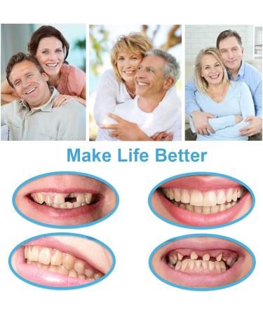 Temporary Tooth Repair Kit with Fitting Beads & Fake Teeth - Ideal for Fixing Missing or Broken Teeth - Buy Online on GoSupps.com