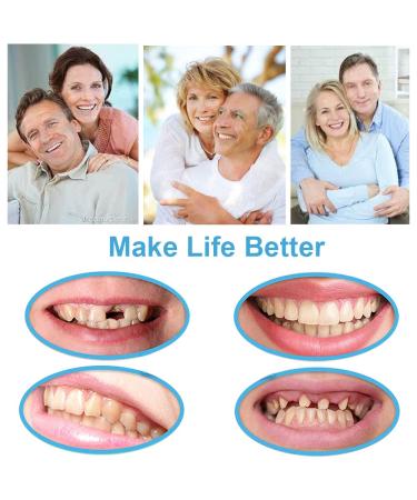 Tooth Repair Kit: Temporary Fix for Missing, Chipped, Broken Teeth - Thermal Beads & Brace Mold Included - Buy Online on GoSupps.com