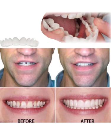  2 Pairs Comfortable Temporary Smile Restore Confidence with Natural Look Temporarily Adjustable for Men and Women Teeth Whitening Kits (1) - Buy Online on GoSupps.com