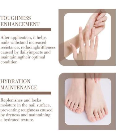  Generisch Hyaluronic Acid Nail Care with Vitamin E and Jojoba Oil - Intensive Moisturizing Treatment for Nails and Cuticles - Nail Care and Nail Polish - Buy Online on GoSupps.com