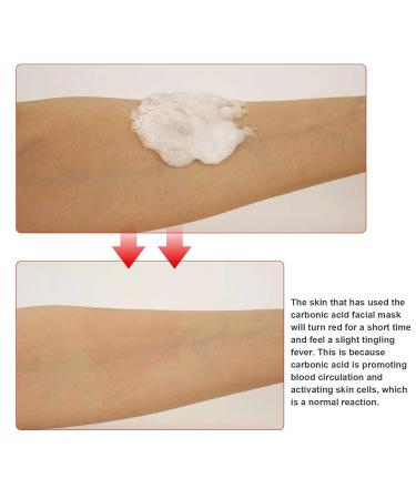 Elitzia CO2 Carboxy Gel Mask - Cellulite Reduction 1 Box (20 Bags) - Blue ET1719 - Buy Online on GoSupps.com