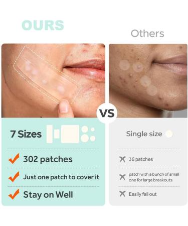 XFSRG 302 large patches of pimples with tea tree oil of salicylic acid and niacinamide for large pimples on chin cheeks back Transparent1 - Buy Online on GoSupps.com