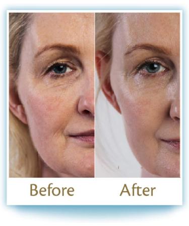 PureHA Oral Hyaluronic Acid Supplements - 30 Days Supply for Youthful Skin - Buy Online on GoSupps.com