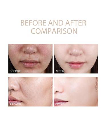 Exfoliating Gel Purifying Exfoliating Gel for Dark Spot Dark Spots Remover Facial Exfoliator Cleanser Deep Cleansing Facial Cleanser Scrub for All Skin Types (2pcs) - Buy Online on GoSupps.com