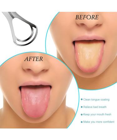 CPsyte Double Head Tongue Cleaner - Optimal Oral Hygiene & Bad Breath Relief | Travel-Friendly Metal Tongue Scraper for Adults - Buy Online on GoSupps.com