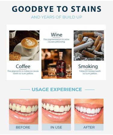 Teeth Whitening Strips for Sensitive Teeth - 30 Enamel Safe Strips Fast 30-Minute Results SGS Certified Mint Flavor - Buy Online on GoSupps.com
