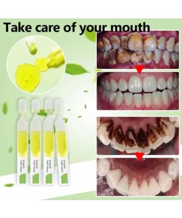 Tlopa Ampoule Toothpaste & Tartar Removal Serum | Whitening & Plaque Control | 3V Fruit Acid - 3 Boxes | International Shipping - Buy Online on GoSupps.com