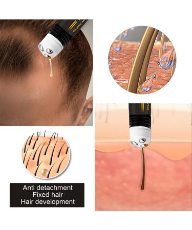 Encomy Roll-On Hair Growth Serum | Organic Regrowth Serum for Women & Men | Prevent Hair Loss & Repair Damaged Follicles - Buy Online on GoSupps.com