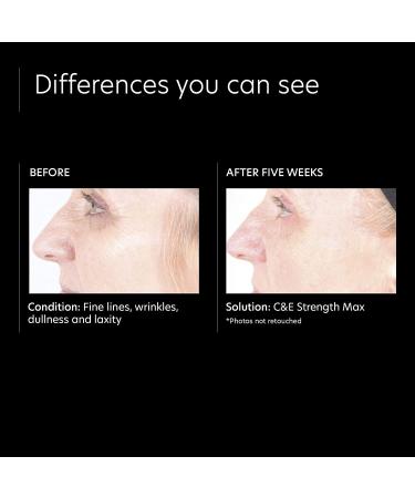 PCA Skin C&E Strength Max Antioxidant Corrective Cream - 1 Fl Oz - Anti-Aging Serum with Vitamin C & E for Brightening & Wrinkle Reduction - Buy Online on GoSupps.com