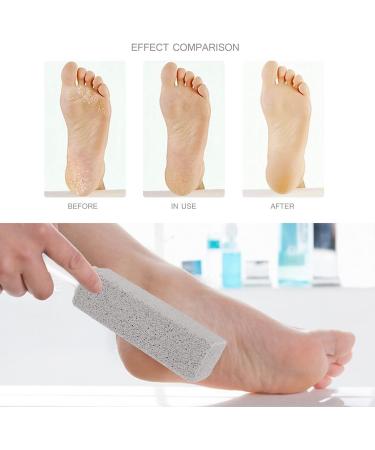 Koshifu Pumice Stone Cleaning Set - 4 Pieces with Handle for Toilet Kitchen Shower & Foot Care - Buy Online on GoSupps.com