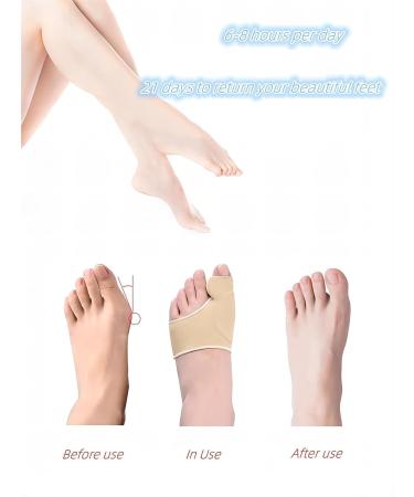 Bunion Corrector for Men and Women - Pain Relief Hallux Valgus Corrector Socks with Splint Pads and Cushion Guards - Orthopedic Support Brace and Toe Spacer for Hammer Toe Relief - Buy Online on GoSupps.com