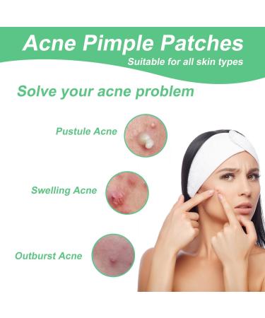 Zebran 300 Pcs Hydrocolloid Pimple Patches - Invisible 2-in-1 Acne Treatment Waterproof Day & Night Solution - Buy Online on GoSupps.com