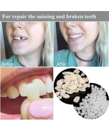 Temporary Tooth Repair Kit with Fitting Beads & Fake Teeth - Ideal for Fixing Missing or Broken Teeth - Buy Online on GoSupps.com