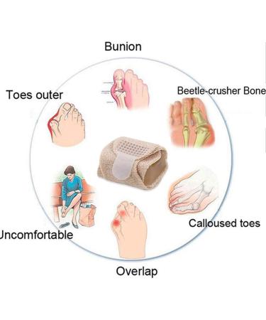 Buy Hammer Toe Straightener & Corrector - Fix Overlapping & Crooked Toes - Buy Online on GoSupps.com
